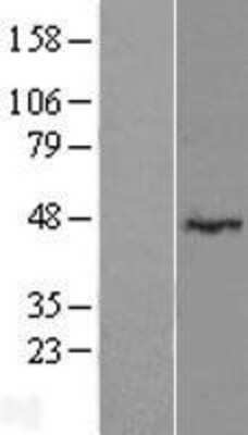 Western Blot: LRRC2 Overexpression Lysate [NBL1-12679]