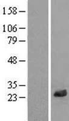 Western Blot: LRRC20 Overexpression Lysate [NBL1-12680]