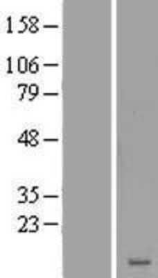 Western Blot: LRRC20 Overexpression Lysate [NBP2-06859]