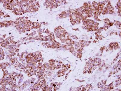 Immunohistochemistry-Paraffin: LRRC23 Antibody [NBP2-17169]