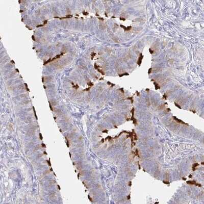 Immunohistochemistry-Paraffin: LRRC23 Antibody [NBP2-38827]