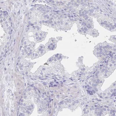 Immunohistochemistry-Paraffin: LRRC23 Antibody [NBP2-38827]