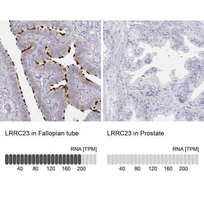 Immunohistochemistry-Paraffin: LRRC23 Antibody [NBP2-38827]