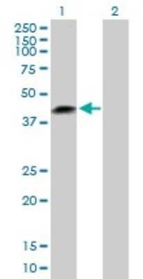 Western Blot: LRRC23 Antibody [H00010233-B01P]