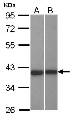 Western Blot: LRRC23 Antibody [NBP2-17170]