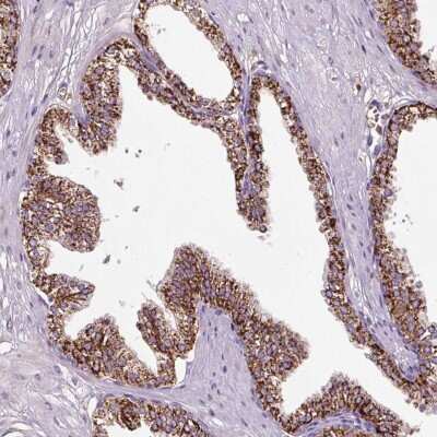 Immunohistochemistry-Paraffin: LRRC24 Antibody [NBP2-33643]