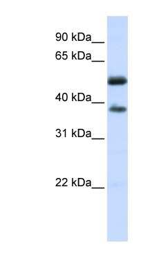 Western Blot: LRRC24 Antibody [NBP1-70621]