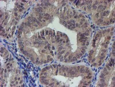 Immunohistochemistry-Paraffin: LRRC25 Antibody (OTI1D9) [NBP2-03747]