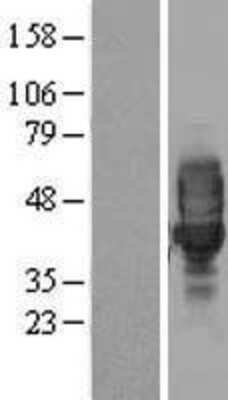 Western Blot: LRRC25 Overexpression Lysate [NBL1-12682]