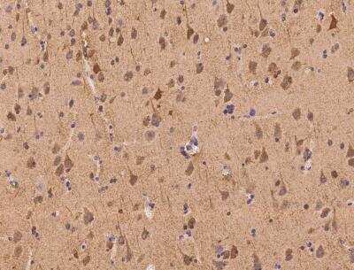 Immunohistochemistry-Paraffin: LRRC27 Antibody [NBP3-06574]