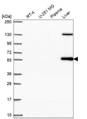 Western Blot: LRRC27 Antibody [NBP2-62655]