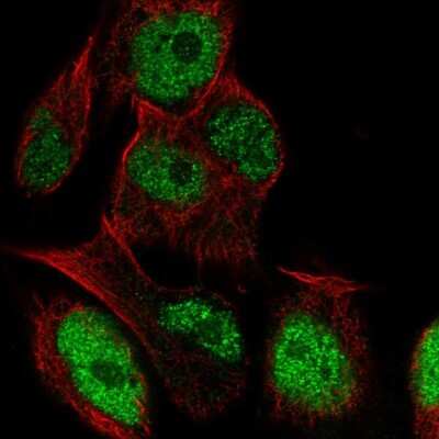 Immunocytochemistry/ Immunofluorescence: LRRC28 Antibody [NBP2-57080]