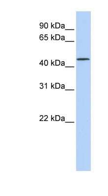 Western Blot: LRRC28 Antibody [NBP1-52848]