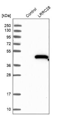 Western Blot: LRRC28 Antibody [NBP2-48706]