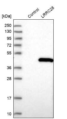 Western Blot: LRRC28 Antibody [NBP2-48726]