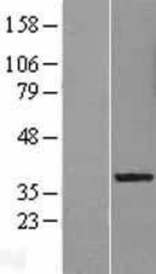 Western Blot: LRRC28 Overexpression Lysate [NBL1-12683]