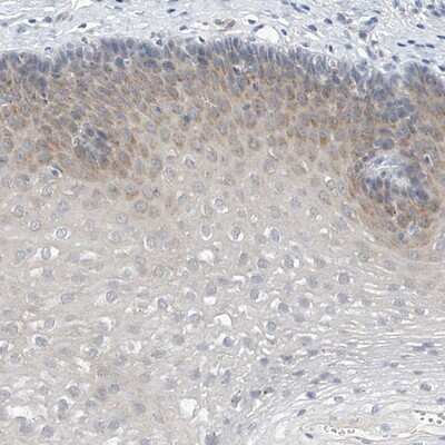 Immunohistochemistry-Paraffin: LRRC29 Antibody [NBP1-83919]