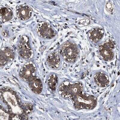 Immunohistochemistry-Paraffin: LRRC3 Antibody [NBP1-88289]