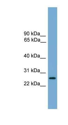 Western Blot: LRRC3 Antibody [NBP1-70624]