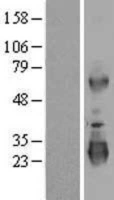 Western Blot: LRRC3 Overexpression Lysate [NBP2-06173]