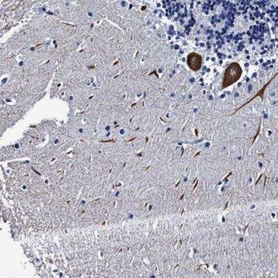 Immunohistochemistry: LRRC30 Antibody [NBP2-30598]