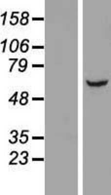 Western Blot: LRRC31 Overexpression Lysate [NBP2-06295]