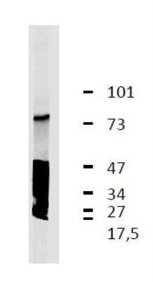 Western Blot: LRRC32/GARP Antibody (GARP5)BSA Free [NBP2-37710]