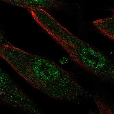 Immunocytochemistry/ Immunofluorescence: LRRC32/GARP Antibody [NBP2-68722]