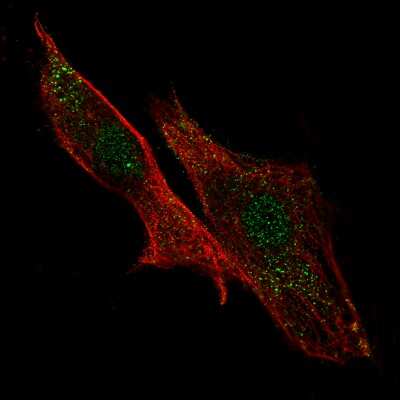 Immunocytochemistry/ Immunofluorescence: LRRC32/GARP Antibody [NBP2-68740]