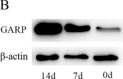 Western Blot: LRRC32/GARP Antibody [NBP2-24664]