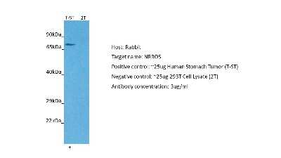 Western Blot: LRRC33 Antibody [NBP2-83151]