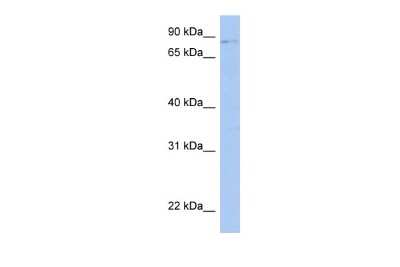 Western Blot: LRRC33 Antibody [NBP2-83152]