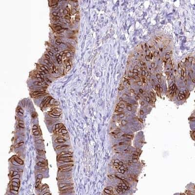 Immunohistochemistry-Paraffin: LRRC34 Antibody [NBP1-81146]