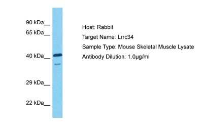 Western Blot: LRRC34 Antibody [NBP2-83153]