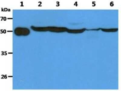 Western Blot: LRRC35 Antibody (1B10)BSA Free [NBP2-59417]