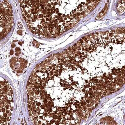 Immunohistochemistry-Paraffin: LRRC35 Antibody [NBP1-89578]