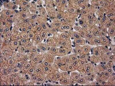 Immunohistochemistry: LRRC35 Antibody (OTI2A9) - Azide and BSA Free [NBP2-72532]