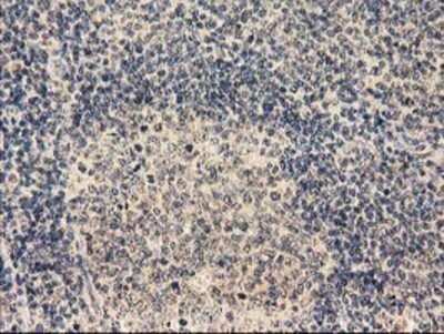 Immunohistochemistry: LRRC35 Antibody (OTI2A9) - Azide and BSA Free [NBP2-72532]