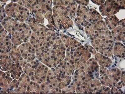 Immunohistochemistry: LRRC35 Antibody (OTI2A9) - Azide and BSA Free [NBP2-72532]