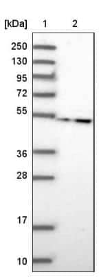 Western Blot: LRRC35 Antibody [NBP2-34051]