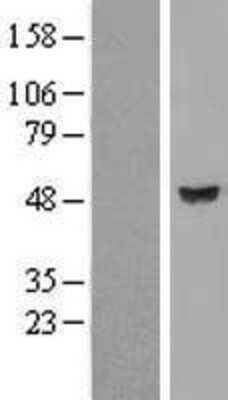 Western Blot: LRRC35 Overexpression Lysate [NBP2-05319]