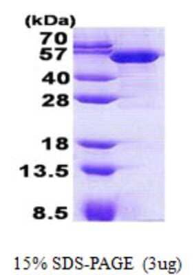 SDS-PAGE: Recombinant Human LRRC35 His Protein [NBP2-22898]