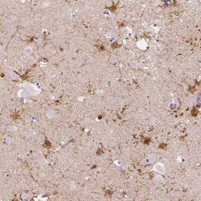 Immunohistochemistry: LRRC36 Antibody [NBP2-31597]