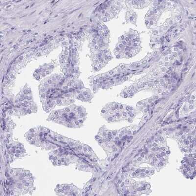 Immunohistochemistry-Paraffin: LRRC36 Antibody [NBP2-31721]