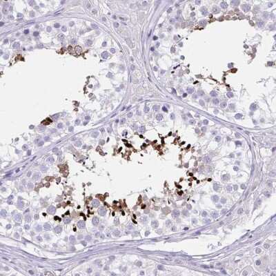 Immunohistochemistry-Paraffin: LRRC36 Antibody [NBP2-31721]