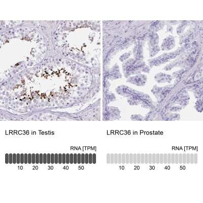 Immunohistochemistry-Paraffin: LRRC36 Antibody [NBP2-31721]