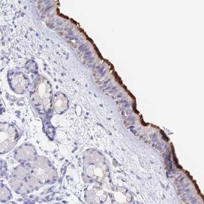 Immunohistochemistry: LRRC37A2 Antibody [NBP2-33438]