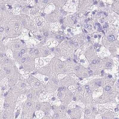 Immunohistochemistry: LRRC37A2 Antibody [NBP2-33438]