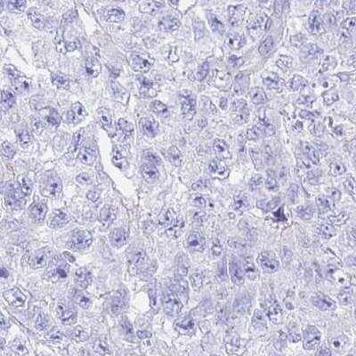 Immunohistochemistry: LRRC37A2 Antibody [NBP2-33438]