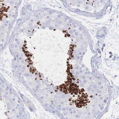 Immunohistochemistry-Paraffin: LRRC37A Antibody [NBP2-46666]